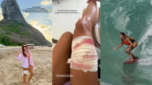 Turista é mordida por tubarão durante mergulho em Fernando de Noronha