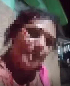 Mulher sofre sessão de tortura e é expulsa de casa após desentendimento com o marido, na Paraíba